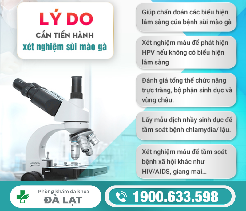 Hình ảnh minh họa